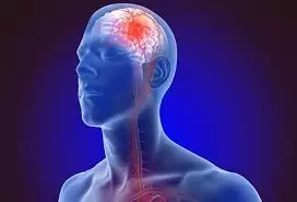 tai-sao-bi-dot-quy-can-benh-co-ty-le-tu-vong-cao-nhat-3